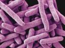 Banner-Mycobacterium-tuberculosis.jpg