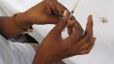 About SCAF-TB